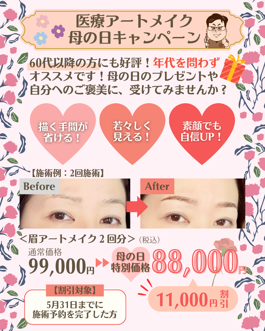 医療アートメイク母の日キャンペーン