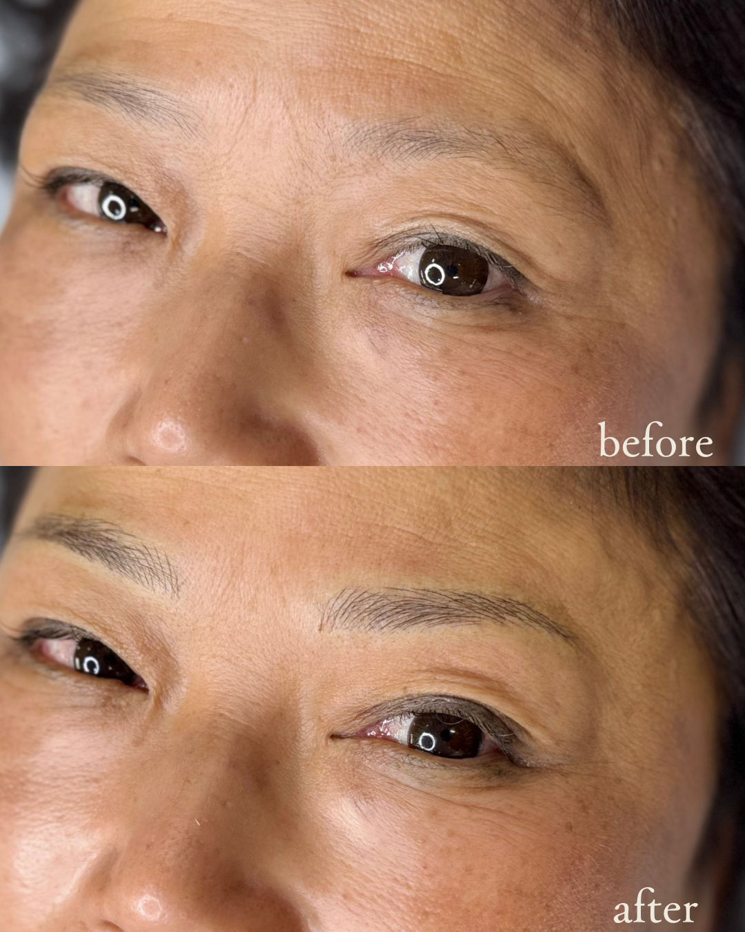 ビフォーアフター